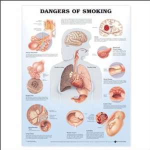 Dangers of Smoking Anatomical Chart 20 X 26 Laminated  