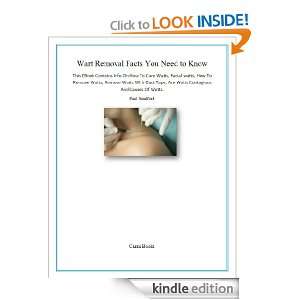 Wart Removal Facts You Need to Know Paul Sandford  Kindle 