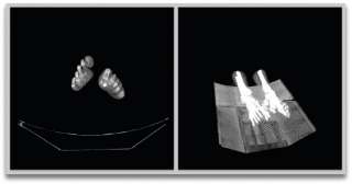 With Volume Rendering, the 2D images from a DICOM stack (left) become 