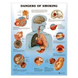  Lww Dangers Of Smoking Anatomical Chart Laminated 9865PL1 
