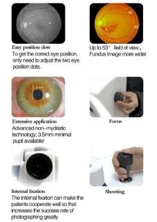   700A Optical Ophthalmic Retinal Fundus Camera Digital System CE  