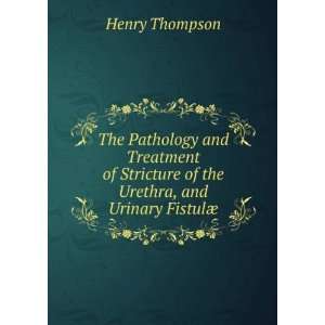   Stricture of the Urethra and Urinary Fistulae Henry Thompson Books