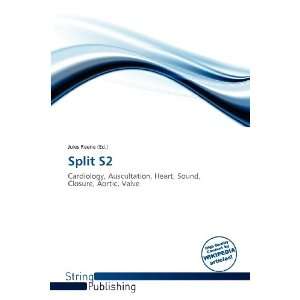  Split S2 (9786138604785) Jules Reene Books