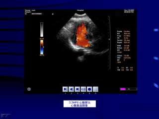 CMS1800 Color Doppler Ultrasonic Diagnostic System, Ultrasound