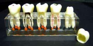 Dental Dentist Clear Study Teaching Demonstration Model Tooth Gift 