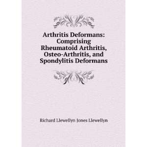   , and Spondylitis Deformans Richard Llewellyn Jones Llewellyn Books